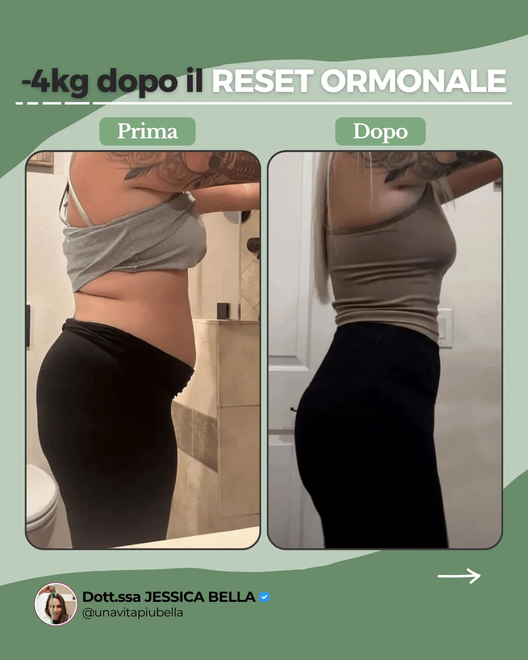 Prima e dopo di una paziente