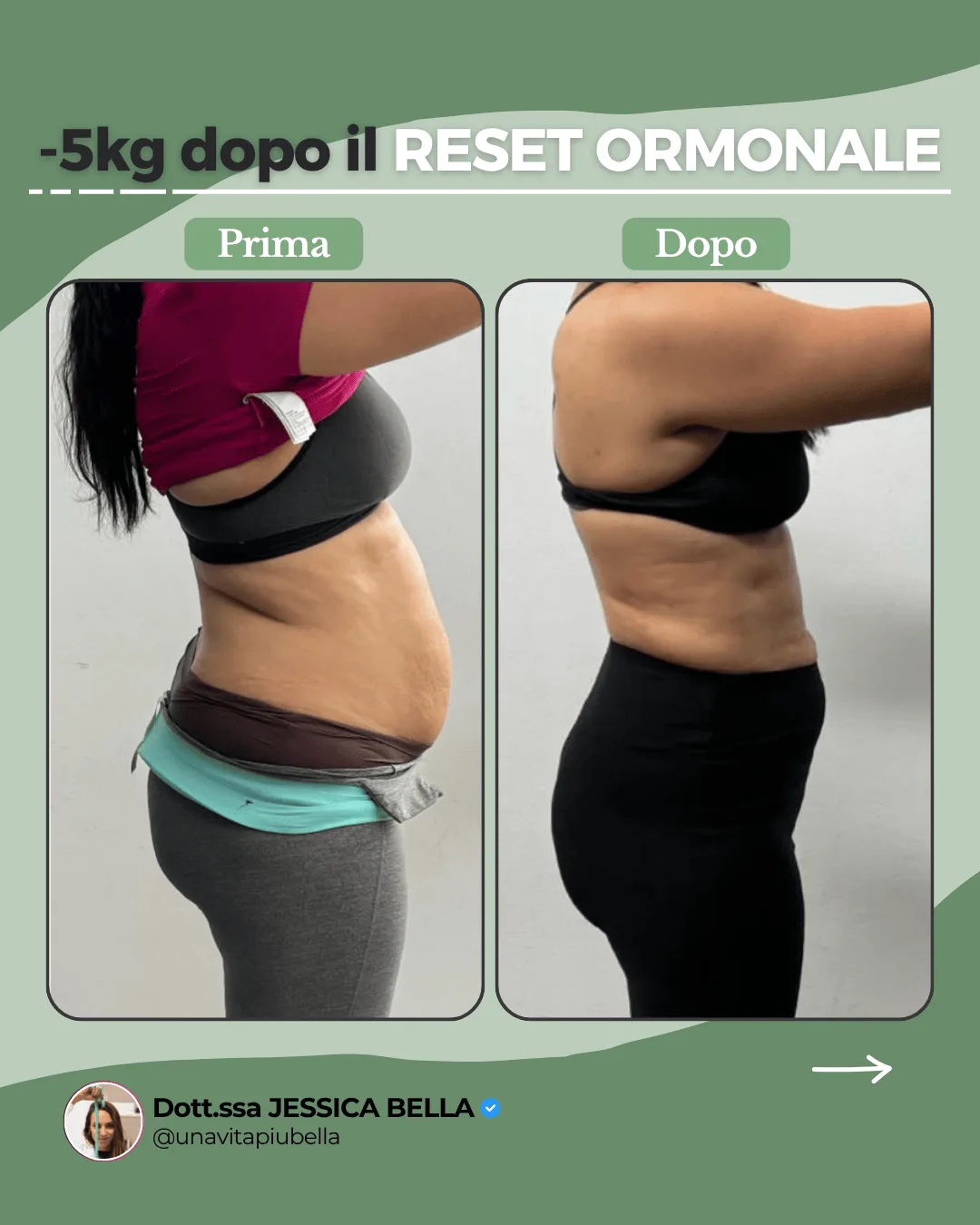 Prima e dopo di una paziente